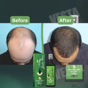 Hair Growth Treatment Spray