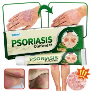 Psoriasis Therapy Cream